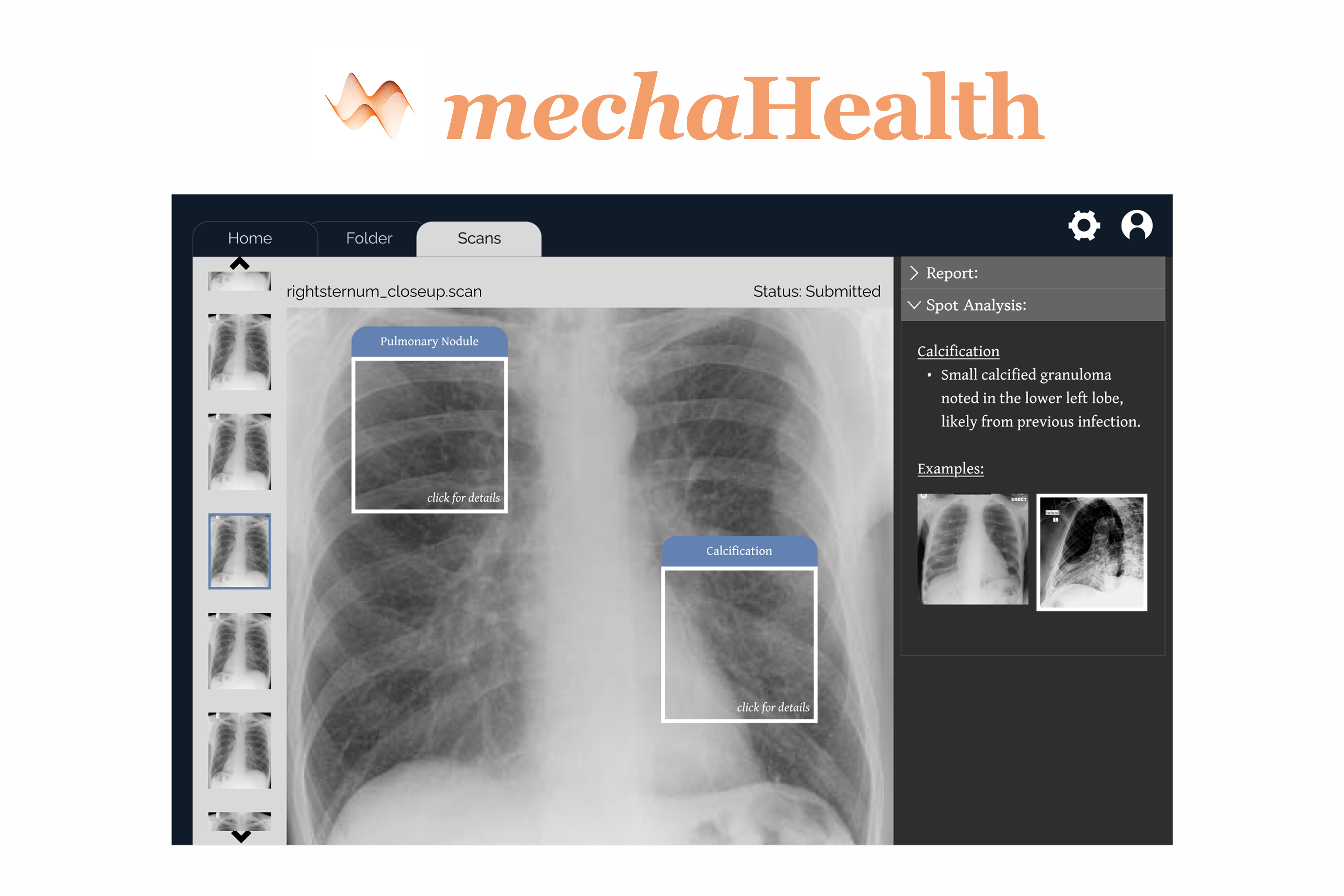 Mecha Health logo